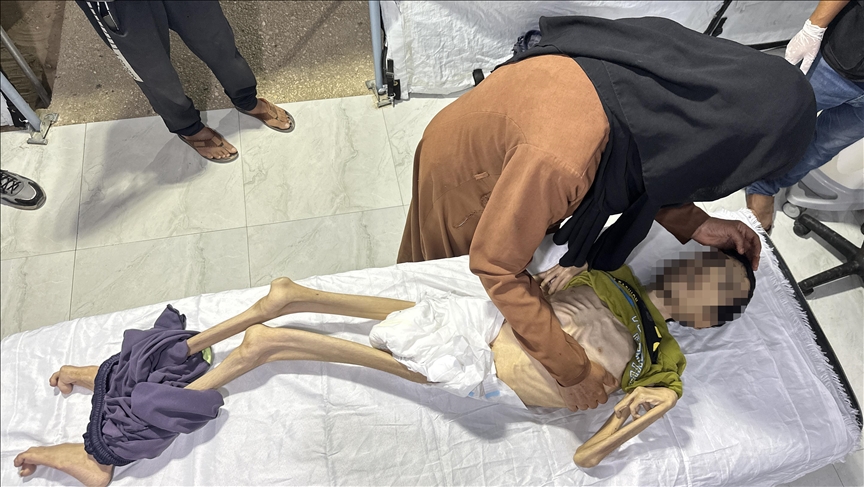 جوان فلسطینی بر اثر سوءتغذیه در غزه جان باخت