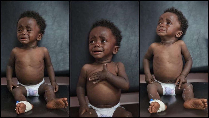 İsrail'in Gazze'deki ablukası, çocukları yetersiz beslenme ve hastalıkların pençesine itiyor