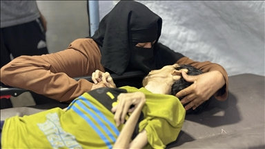 جراء التجويع الإسرائيلي.. وفاة شاب بسوء التغذية في غزة