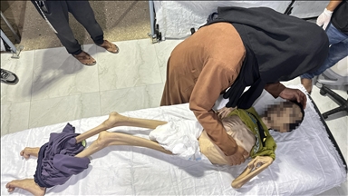 جوان فلسطینی بر اثر سوءتغذیه در غزه جان باخت