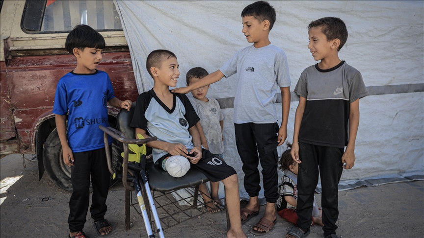 Fëmija palestinez që po shkonte për të marrë ndihma në Gaza, humb këmbën në sulmin izraelit