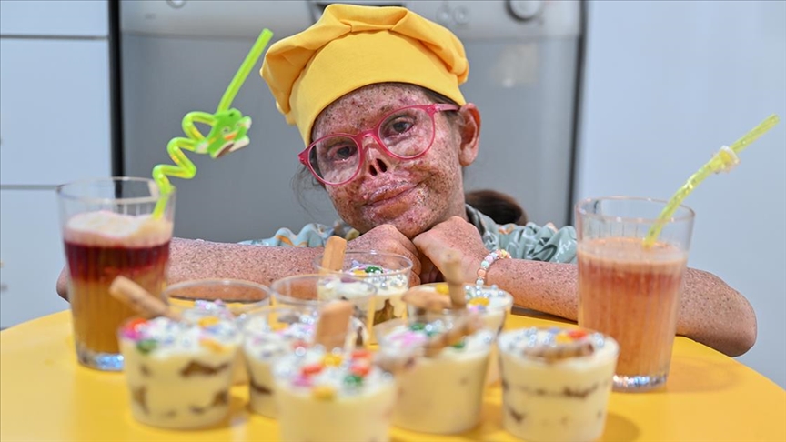 Güneşe hasret küçük Cemile'nin aşçılık hayali gerçekleştirildi