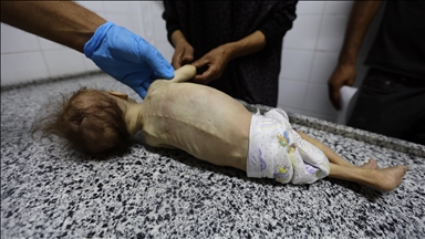 WFP official warns Gaza hunger crisis 'worse than ever,' urges immediate ceasefire