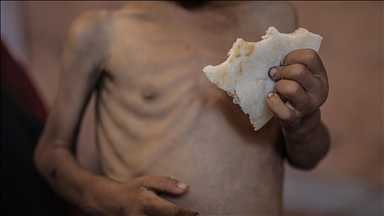 ‘Engineered’ malnutrition: UN agency chief warns about deepening child hunger crisis in Gaza