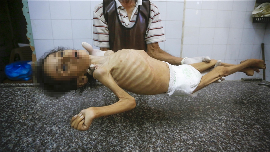 Gaza, një vajzë 4-vjeçare vdiq nga uria pasi Izraeli kufizoi ndihmën
