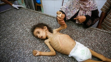 Gaza : une fillette de 4 ans meurt de malnutrition dans un contexte de blocage de l’aide humanitaire par Israël