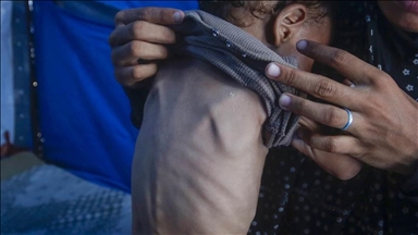 OBSH-ja paralajmëron: Pa ndërhyrje të menjëhershme, kriza e kequshqyerjes në Gaza do të përkeqësohet më tej