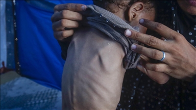 Without immediate intervention, malnutrition crisis in Gaza to deteriorate further, WHO warns