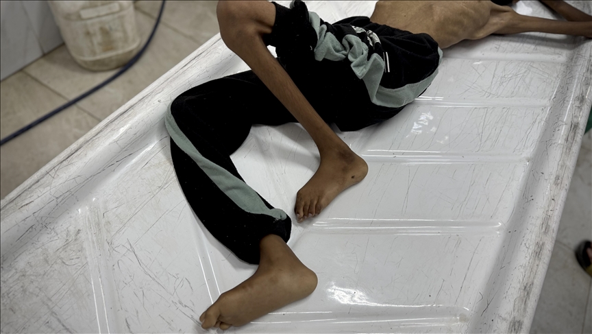 حماس تطالب العرب والمسلمين بـ"موقف للتاريخ" لإنهاء مجاعة غزة