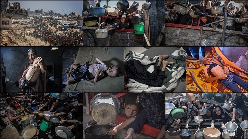 Gaza records 45 cases of acute flaccid paralysis amid worsening famine under Israeli siege Gaza records 45 cases of acute flaccid paralysis amid worsening famine under Israeli siege