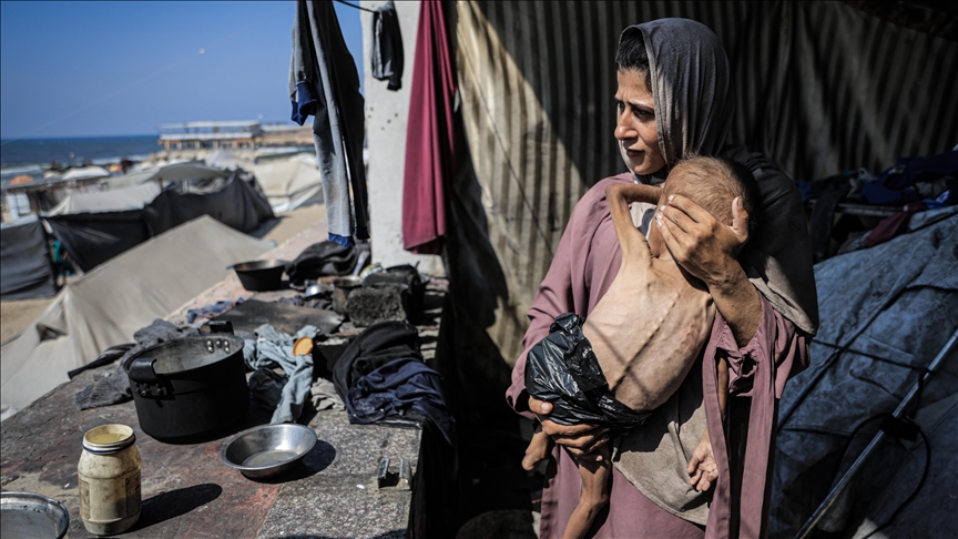 2 children, including baby, die of malnutrition in Israel-besieged Gaza Strip
