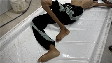 حماس تطالب العرب والمسلمين بـ"موقف للتاريخ" لإنهاء مجاعة غزة