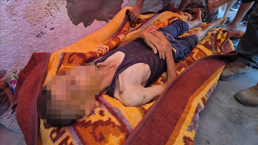 غزة تموت جوعا.. التجويع الإسرائيلي يقتل 10 فلسطينيين خلال 24 ساعة