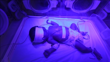 UN agency warns of 'catastrophic birth outcomes' in Gaza amid starvation, health system collapse