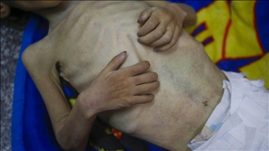 INTERVIEW – Palestinians in Gaza facing ‘most horrific stage of Israel’s starvation campaign’: UN rapporteur