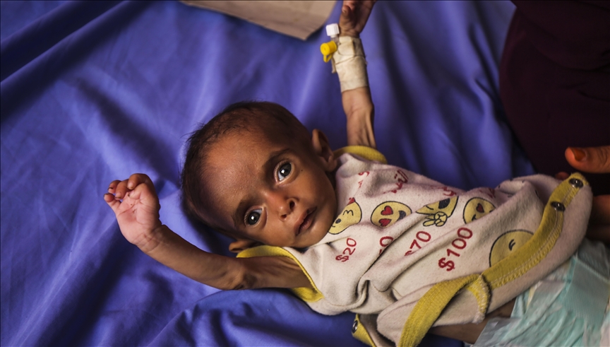 La faim tue dans la Bande de Gaza : Encore deux décès ces dernières 24 heures