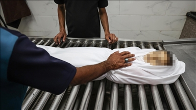نور اخزيق.. رضيعة أخرى يفتك بها الجوع في غزة المحاصرة