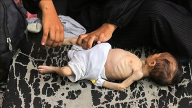 گرسنگی در غزه؛ جان باختن 9 فلسطینی دیگر از جمله دو کودک