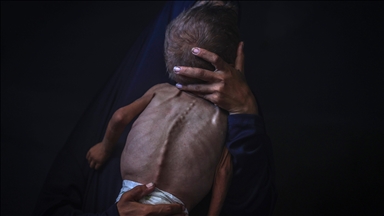 9 more Palestinians, including 2 children, die of starvation in Gaza amid Israeli blockade