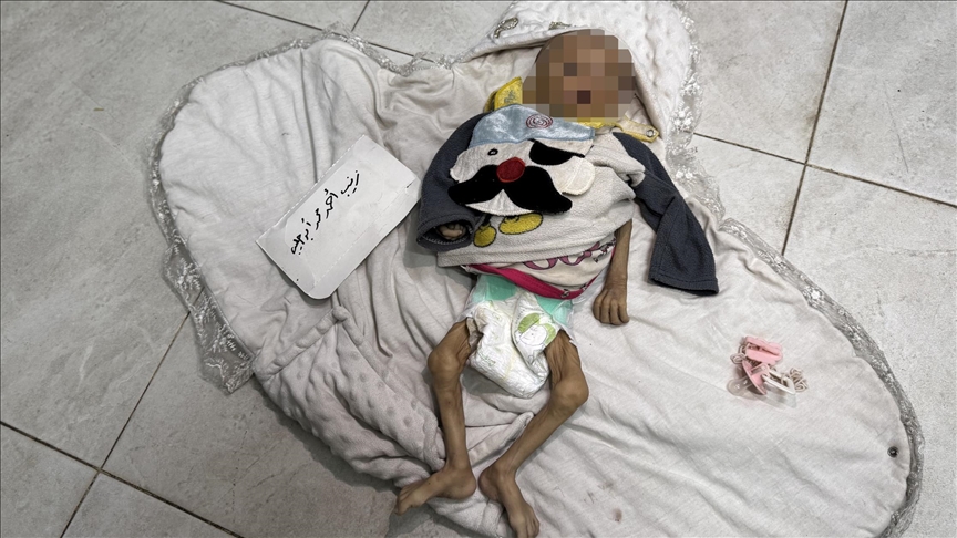 الرضيعة زينب أبو حليب.. ضحية جديدة لتجويع غزة 