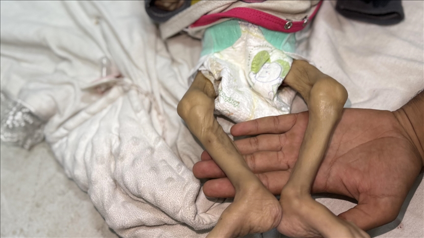 Gaza facing ‘constructed, deliberate’ mass starvation, says UN agency
