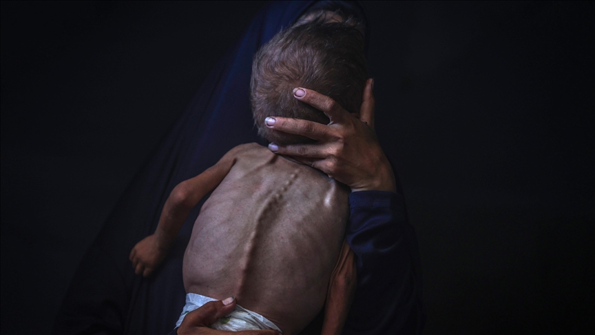 Gaza faces imminent mass death of 100,000 children amid baby formula shortage