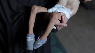 Famine kills 5 more Palestinians in last 24 hours in Israel-besieged Gaza: Health Ministry