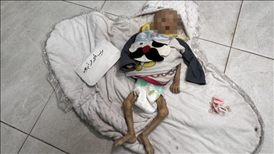 الرضيعة زينب أبو حليب.. ضحية جديدة لتجويع غزة 