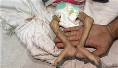 Another Palestinian infant dies from malnutrition in Gaza due to Israeli blockade