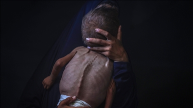 Gaza faces imminent mass death of 100,000 children amid baby formula shortage
