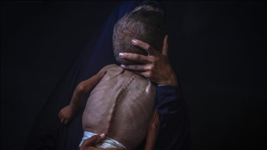 Gaza përballet me vdekjen masive të afërt të 100 mijë fëmijëve për shkak të mungesës së formulës për foshnja