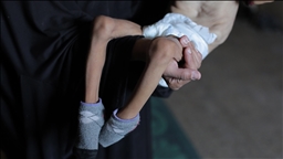 Famine kills 5 more Palestinians in last 24 hours in Israel-besieged Gaza: Health Ministry