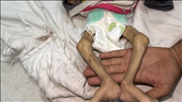 Gaza facing ‘constructed, deliberate’ mass starvation, says UN agency