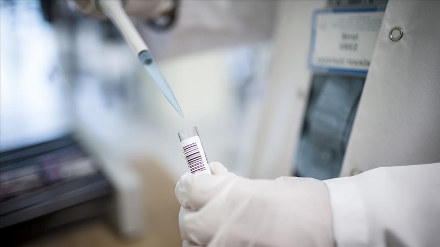 Ghana confirms 1st mpox death