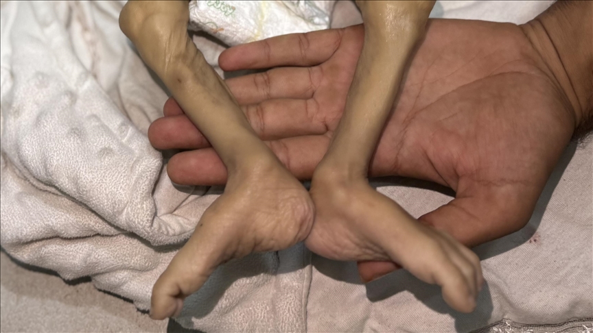 İsrail'in kıtlığı dayattığı Gazze'de son 24 saatte 2'si çocuk 6 Filistinli açlıktan hayatını kaybetti
