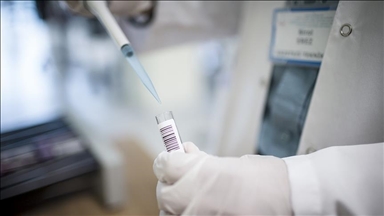 Ghana confirms 1st mpox death