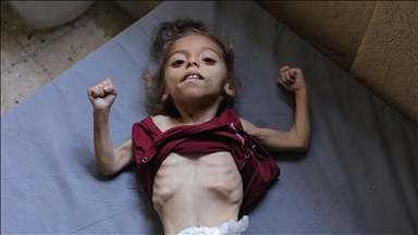 غزة تموت جوعا.. التجويع الإسرائيلي يقتل 6 فلسطينيين خلال 24 ساعة 