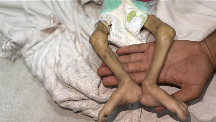 Un autre bébé meurt de faim à Gaza