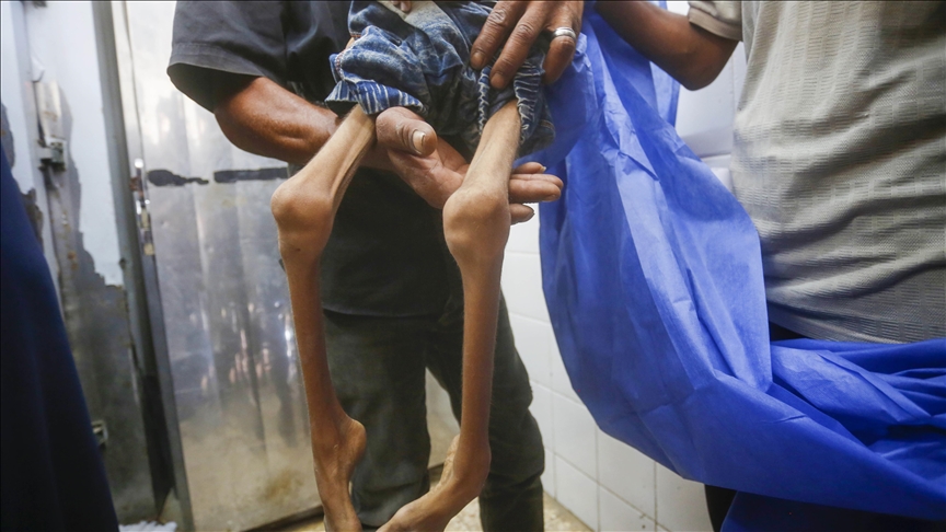 Another Palestinian infant dies from malnutrition in Gaza due to Israeli blockade