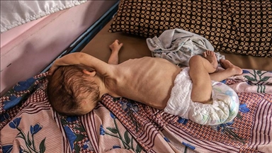 بیش از 40 هزار نوزاد زیر یک سال در غزه در معرض خطر «مرگ تدریجی» هستند