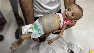 غزة تقتل جوعا.. 40 ألف رضيع مهددون بالموت لمنع إسرائيل حليب الأطفال 