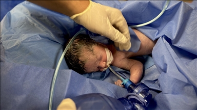 Baby saved from womb of mother killed in Israeli strike in Gaza