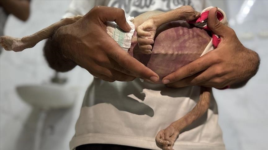 نەتەوە یەکگرتووەکان: "پێویستە بەپەلە یارمەتی مرۆیی زیاتر بگەیەندرێتە غەززە"