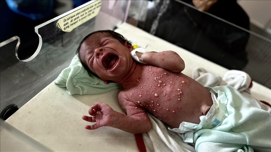 Gaza, foshnjat përpiqen të mbijetojnë nën bllokadën izraelite