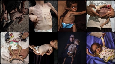 Djeca koja umiru od gladi u Gazi najbolnije lice humanitarne tragedije