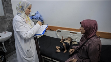 Mjekja e foshnjës palestineze që u bë simbol i urisë në Gaza i përgënjeshtron pretendimet e Izraelit