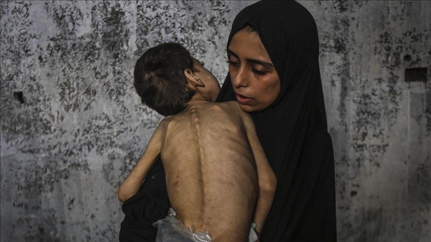 Para ahli sebut Israel hadapi isolasi global yang semakin meningkat akibat perang di Gaza