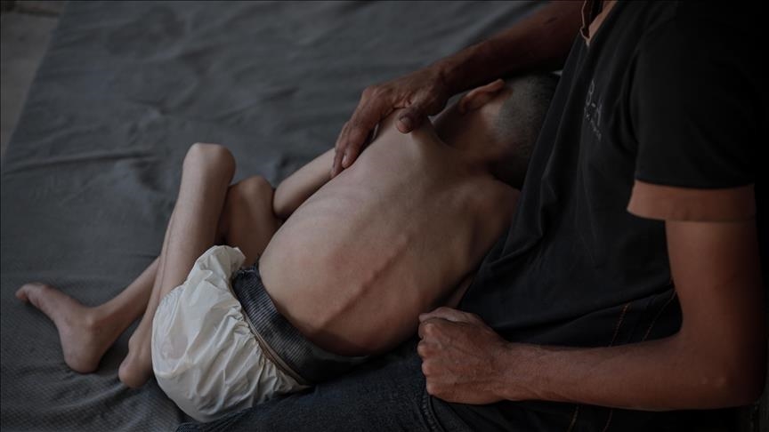 Starvation kills 7 more Gazans amid Israeli siege: Health Ministry
