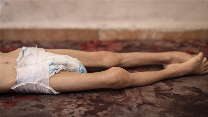 2 more Gazans die of starvation as Israel maintains choking blockade