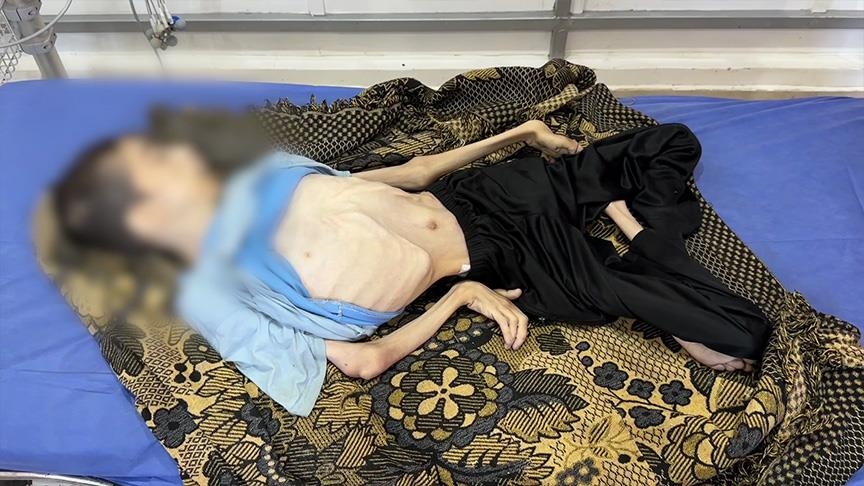 كرم الجمل.. شاب فلسطيني ضحية جديدة لتجويع غزة
